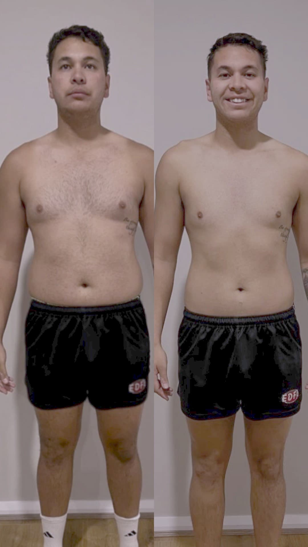 Brandon, before and after